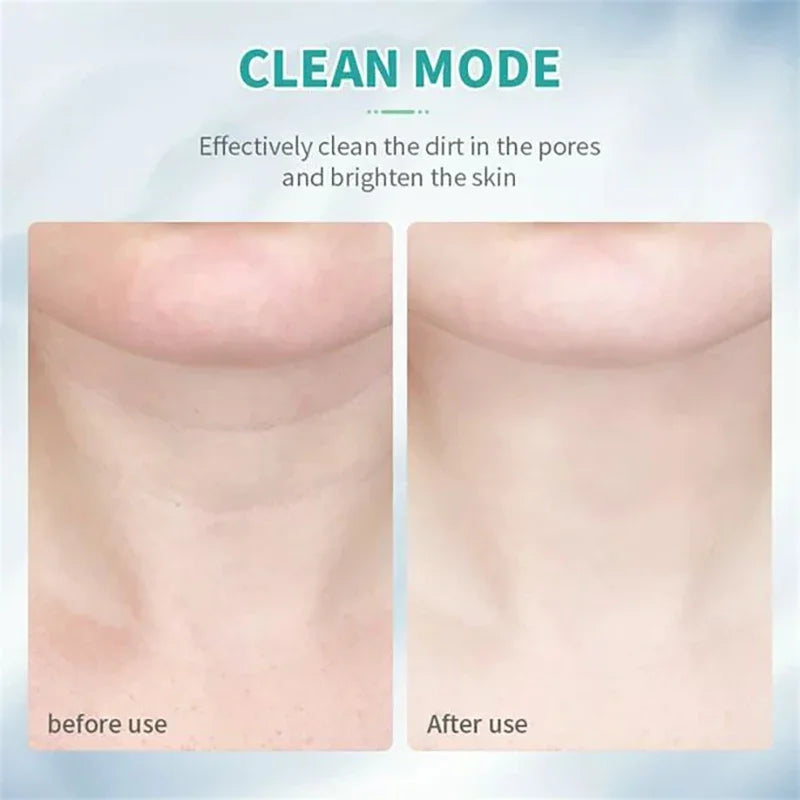 Youthful Radiance Face & Neck Lift