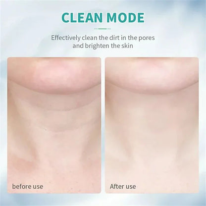 Youthful Radiance Face & Neck Lift